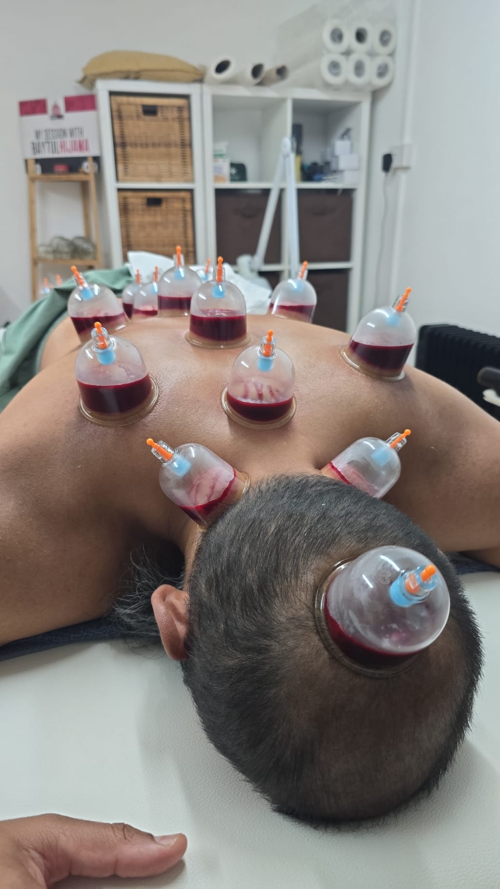 Full back and head cupping